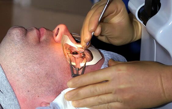 Skleroplastik bei Myopie zur Stabilisierung des Sehvermögens